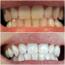 Load image into Gallery viewer, Snow® At-Home Teeth Whitening Kit - 50% Off